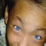 神奇!9岁男童天生蓝色猫眼有夜视功能（图） - 长沙新闻网