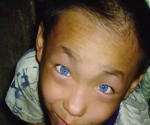 神奇!9岁男童天生蓝色猫眼有夜视功能（图） - 长沙新闻网