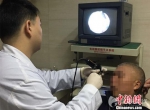 49岁男子鼻腔频繁出血 就诊取出5厘米长蚂蝗(图) - 长沙新闻网