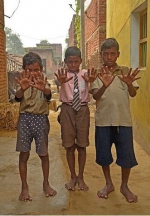 印度一家族人人有12根手指和12根脚趾 (图) - 长沙新闻网