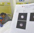 强强住进四川结石病医院，输尿管镜检查报告单显示：临床诊断为膀胱结石 - 长沙新闻网