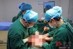 常德女子体内取出13斤巨型肿瘤 医生称“活久见” - 湖南红网