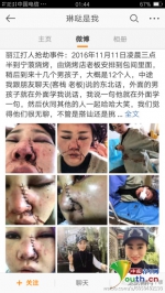 丽江被打毁容女子：我真的没有骂过丽江 - 长沙新闻网