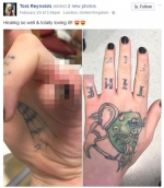 疯狂!英女子受情伤割掉纹身自断手指称“我愿意” - 长沙新闻网